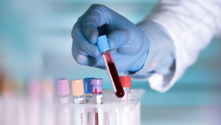 اختبار جديد لفحص أنواع سرطانات مختلفة يشكل نقلة نوعية في عالم الطب