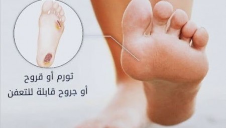 أطباء يكشفون أعراضاً غريبة لمصابي كورونا ..