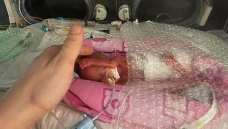 ولادة أصغر طفل خديج في المملكة المتحدة منذ عقدين بوزن 325 غرام