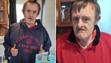 بريطانيا: كلاب تقتل رجلاً ستينيا مصاباً بمتلازمة داون.. والشرطة تحقق في الحادثة