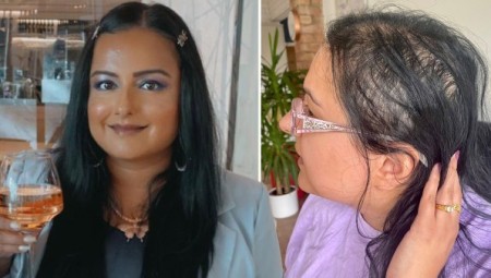 تجربة مروعة.. بريطانية تفقد شعرها بسبب كورونا ومنتج بـ 8 جنيهات يعيد نموه