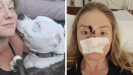 صور حساسة: سيدة تفقد أنفها بعد  تعرضها لهجوم من كلب صديقها... والسبب بريق أسنانها!