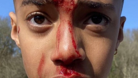 بريطانيا.. سيدة تعتدي على طفل مصاب بالتوحد وتضربه بالمجرفة على رأسه في الحديقة