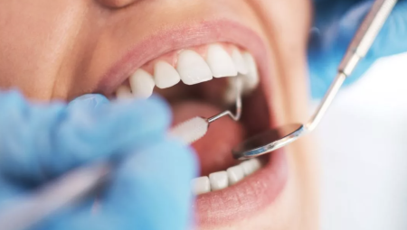 أكثر من مليوني شخص عاجزون عن الحصول على رعاية أسنان عاجلة في NHS