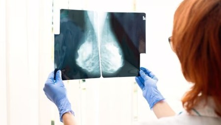 خلل تقني في NHS يؤدي إلى تشخيص متأخر لمرض السرطان لدى 10 مرضى ويسبب وفيات