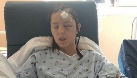 مثير.. سيدة بريطانية تخضع لجراحة دون تخدير لـ10 ساعات